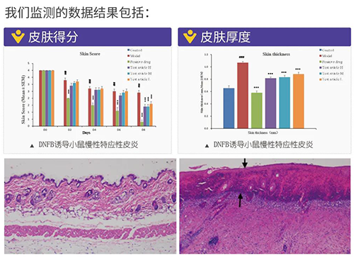BBIN游戏建设的特应性皮炎及湿疹模子监测数据效果