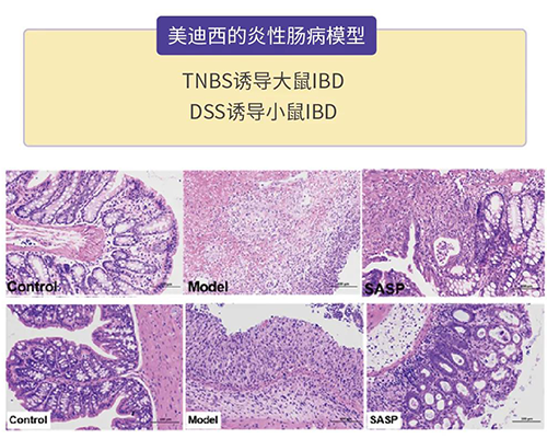 BBIN游戏的炎症性肠病模子