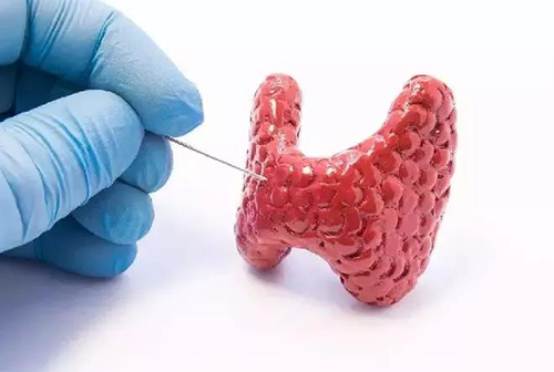 甲状腺疾病。。。。。，，，包括甲状腺功效减退和甲状腺功效亢进，，，，自古以来就是重复被医学研究职员研究的疾病