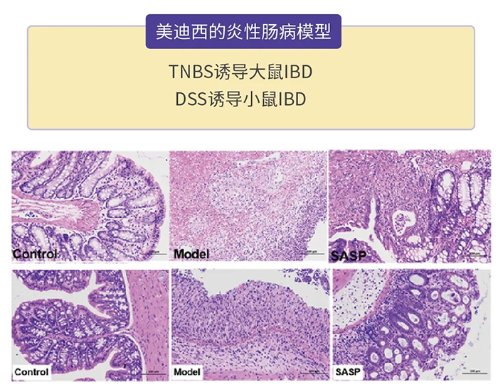 BBIN游戏的炎性肠病模子.png